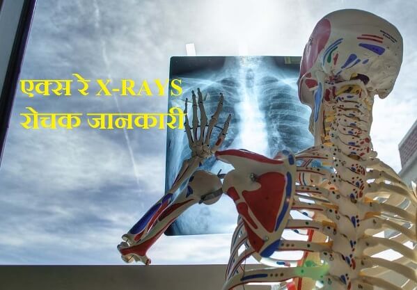 what is x-ray in hindi